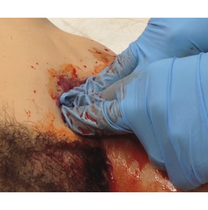 TacMed Solutions Hemostatic Wound Trainer (HEMO)